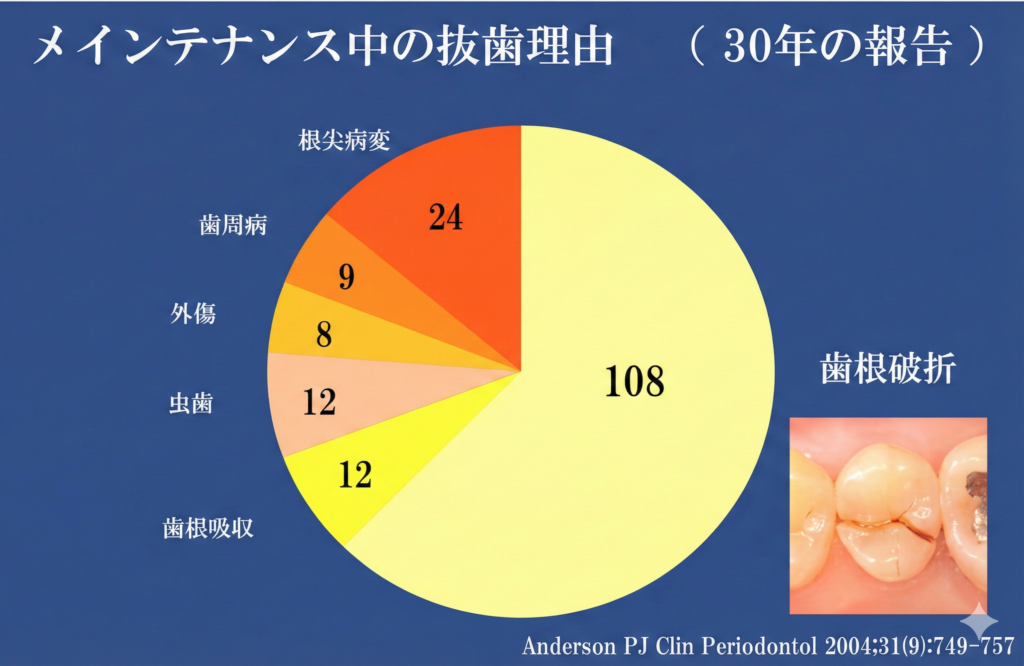 30年間におけるメインテナンス中の抜歯理由のグラフ