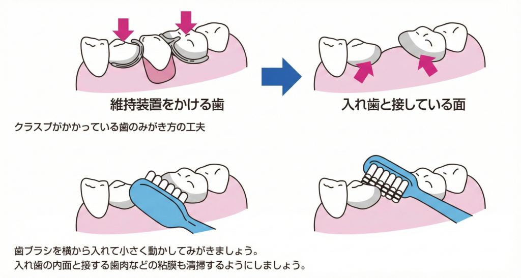 入れ歯のお手入れ方法の説明