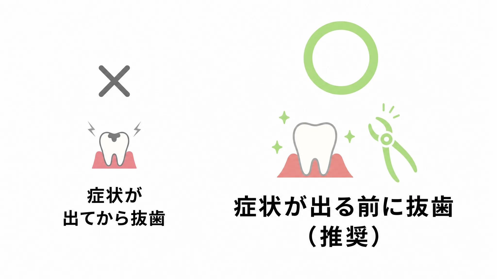 親知らずの抜歯は、症状が出てからより、症状が出る前に行うことが推奨される